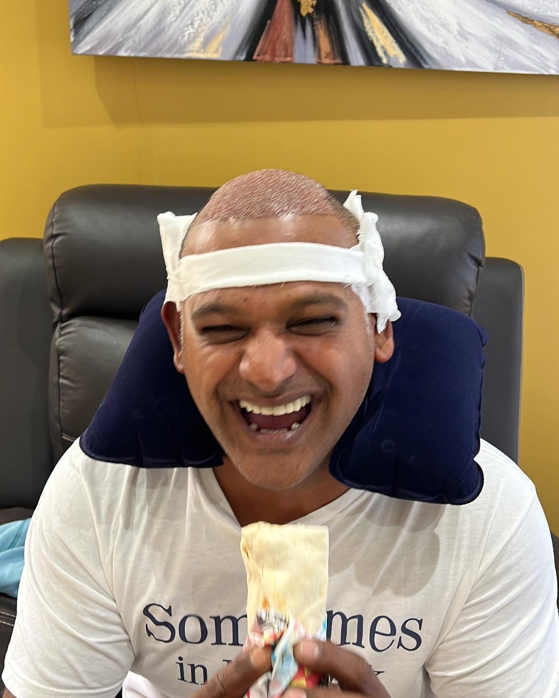 Patient after a hair restoration appointment